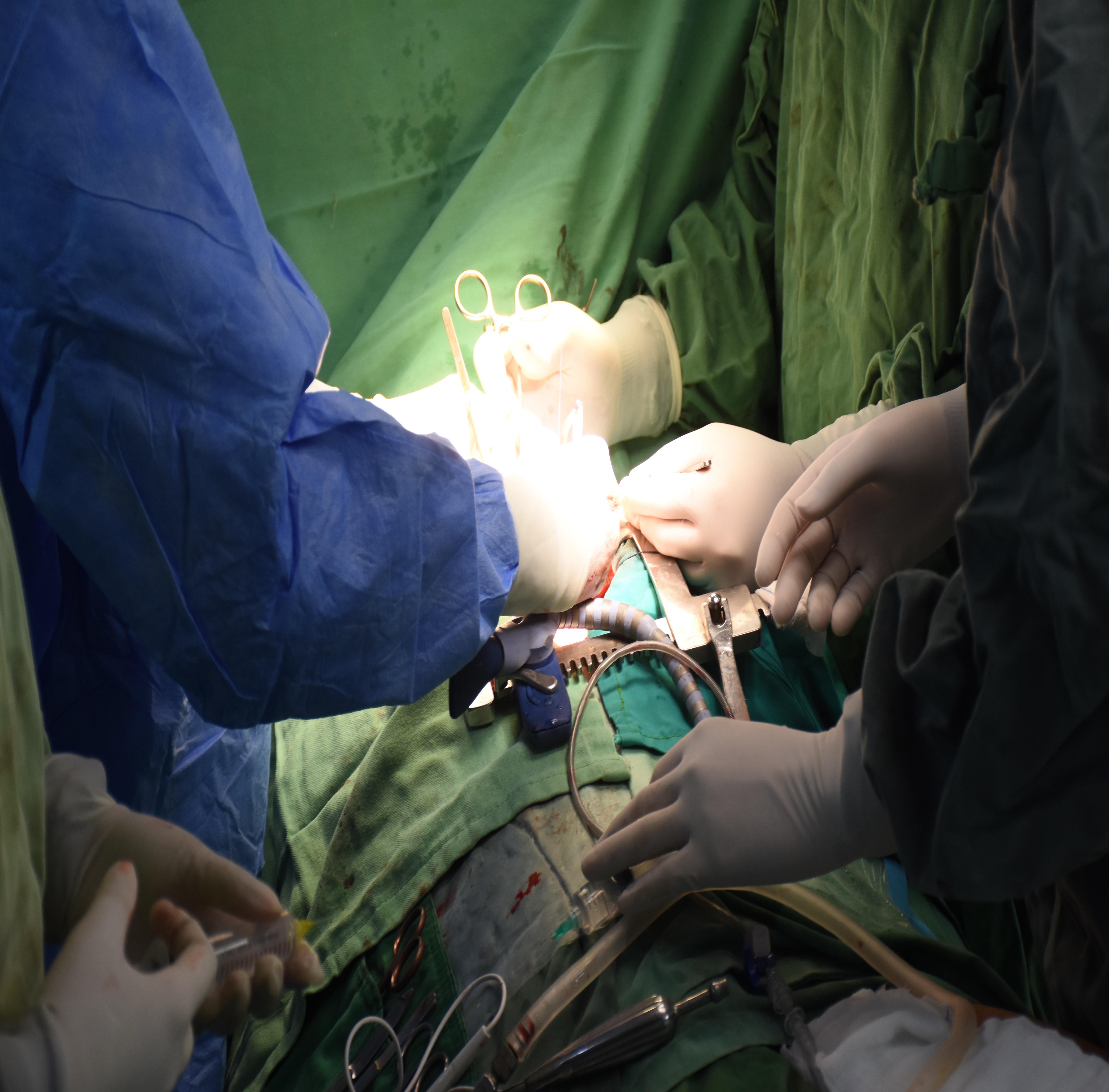 Adult Cardiac Surgery